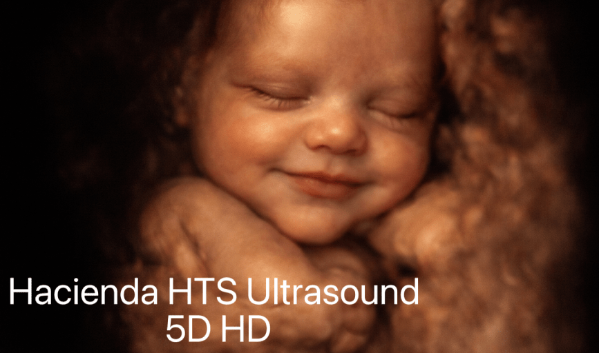 Hacienda HTS Ultrasound